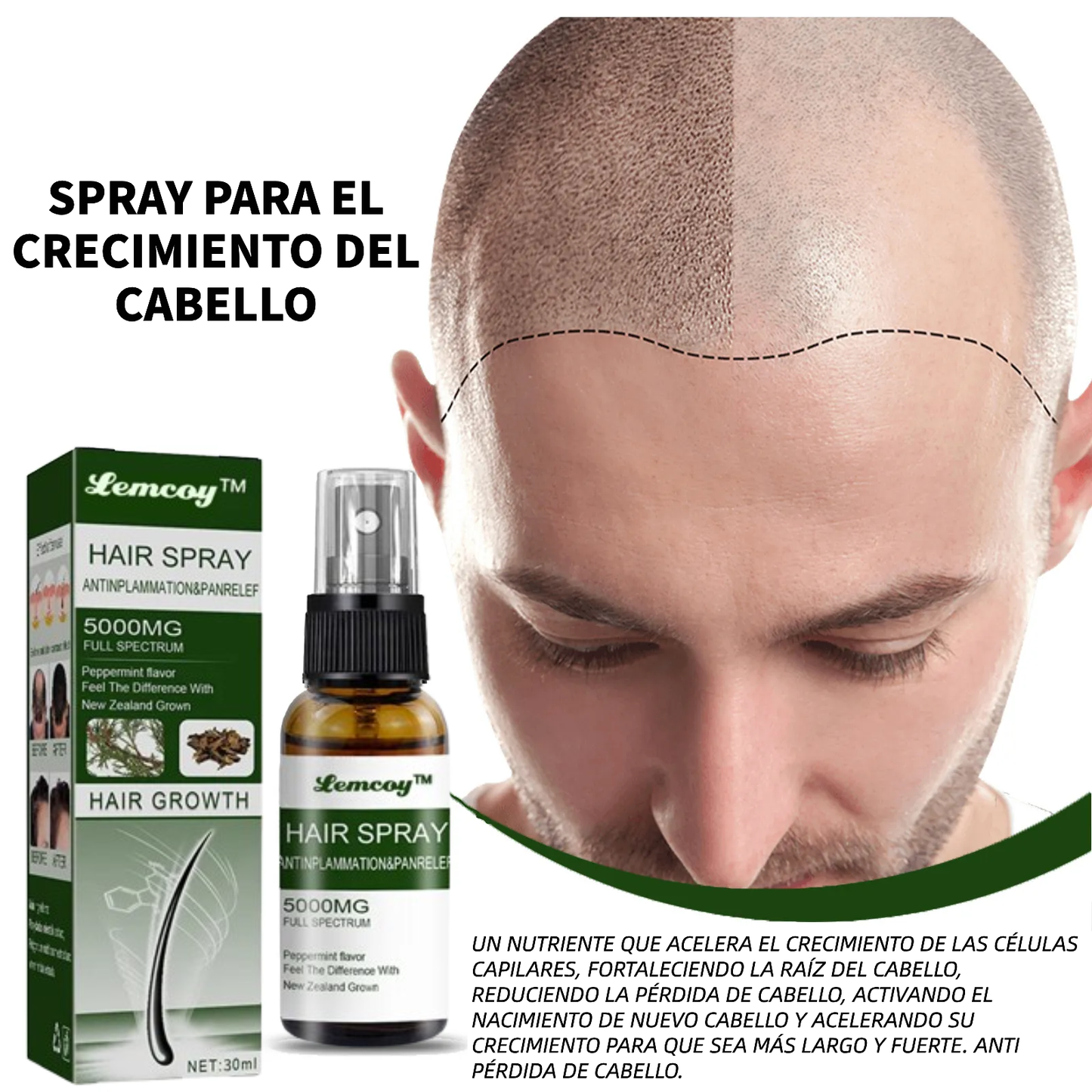 Lemocy™ Ashwagandha 5000 Spray definitivo para el crecimiento del cabello