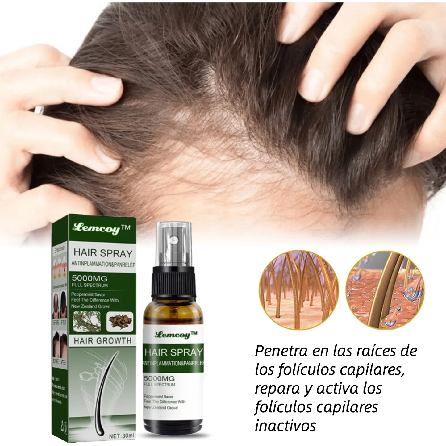 Lemocy™ Ashwagandha 5000 Spray definitivo para el crecimiento del cabello